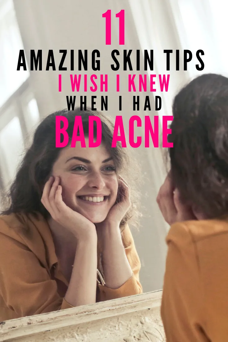 get rid of acne