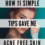 get rid of acne