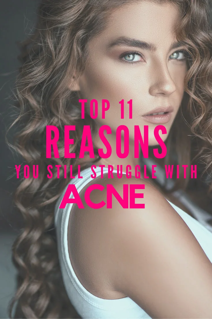 get rid of acne